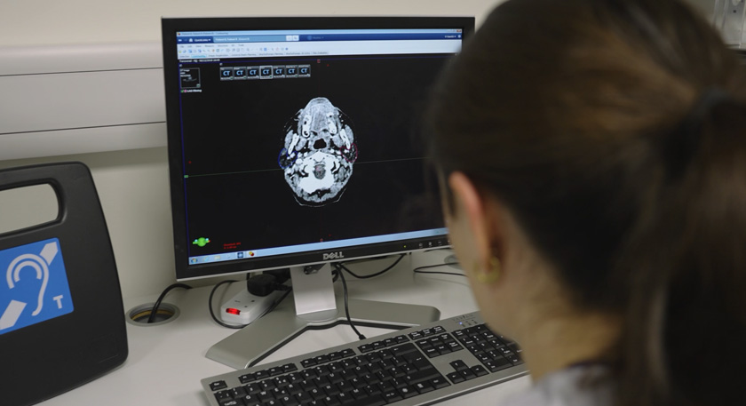 A close up of some radiography software showing what appears to be an x-ray of a human skull.