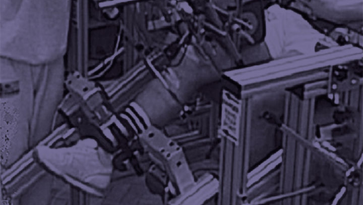 B+W photo of someone with their leg in some sort of medical machinery
