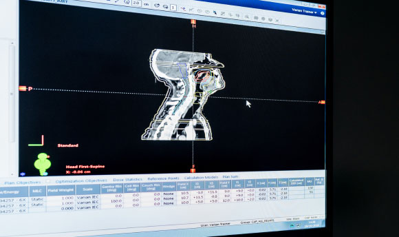 An xray being viewed within a piece of radiography software.
